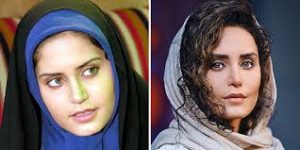 عملها و تغییرات زیبایی در چهره الناز شاکردوست