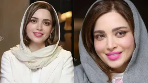 ✨ راز زیبایی بهنوش طباطبایی؛ از تغییرات ظریف تا چهرهای ماندگار