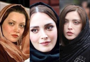 ✨ راز زیبایی بهنوش طباطبایی؛ از تغییرات ظریف تا چهرهای ماندگار