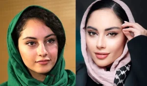 راز زیبایی ترلان پروانه