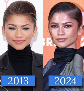 تغییرات چهرهی زندایا از نگاه متخصصان زیبایی