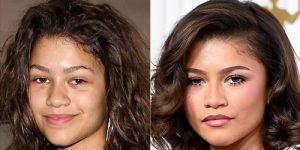 تغییرات چهرهی زندایا از نگاه متخصصان زیبایی